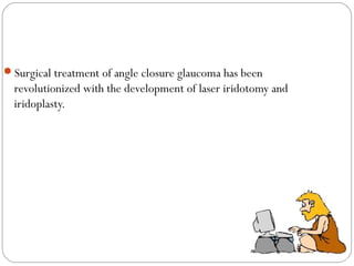 Surgical treatment of angle closure glaucoma has been
revolutionized with the development of laser iridotomy and
iridoplasty.
 