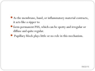 As the membrane, band, or inflammatory material contracts,
it acts like a zipper to
form permanent PAS, which can be spotty and irregular or
diffuse and quite regular.
 Pupillary block plays little or no role in this mechanism.
08/22/15
 