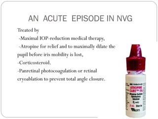 AN ACUTE EPISODE IN NVG
Treated by
-Maximal IOP-reduction medical therapy,
-Atropine for relief and to maximally dilate the
pupil before iris mobility is lost,
-Corticosteroid.
-Panretinal photocoagulation or retinal
cryoablation to prevent total angle closure.
 