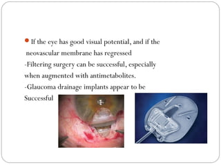 If the eye has good visual potential, and if the
neovascular membrane has regressed
-Filtering surgery can be successful, especially
when augmented with antimetabolites.
-Glaucoma drainage implants appear to be
Successful
 