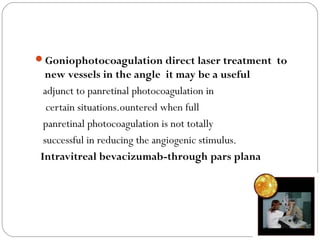 Goniophotocoagulation direct laser treatment to
new vessels in the angle it may be a useful
adjunct to panretinal photocoagulation in
certain situations.ountered when full
panretinal photocoagulation is not totally
successful in reducing the angiogenic stimulus.
Intravitreal bevacizumab-through pars plana
 