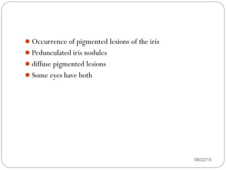Occurrence of pigmented lesions of the iris
Pedunculated iris nodules
diffuse pigmented lesions
Some eyes have both
08/22/15
 