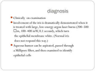diagnosis
Clinically on examination
Involvement of the iris is dramatically demonstrated when it
is treated with large, low-energy argon laser burns (200–500
m, 100–400 mW, 0.1 second), which turn
the epithelial membrane white. (Normal iris
does not respond this way.)
Aqueous humor can be aspirated, passed through
a Millipore filter, and then examined to identify
epithelial cells
 