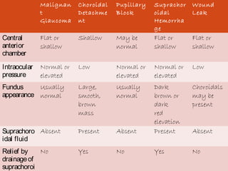 08/22/15
Malignan
t
Glaucoma
Choroidal
Detachme
nt
Pupillary
Block
Suprachor
oidal
Hemorrha
ge
Wound
Leak
Central
anterior
chamber
Flat or
shallow
Shallow May be
normal
Flat or
shallow
Flat or
shallow
Intraocular
pressure
Normal or
elevated
Low Normal or
elevated
Normal or
elevated
Low
Fundus
appearance
Usually
normal
Large,
smooth,
brown
mass
Usually
normal
Dark
brown or
dark
red
elevation
Choroidals
may be
present
Suprachoro
idal fluid
Absent Present Absent Present Absent
Relief by
drainageof
suprachoroi
No Yes No Yes No
 