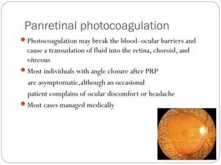 Panretinal photocoagulation
Photocoagulation may break the blood–ocular barriers and
cause a transudation of fluid into the retina, choroid, and
vitreous
Most individuals with angle closure after PRP
are asymptomatic,although an occasional
patient complains of ocular discomfort or headache
Most cases managed medically
 