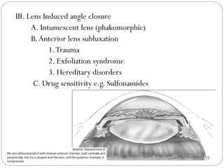 08/22/15
III. Lens Induced angle closure
A. Intumescent lens (phakomorphic)
B.Anterior lens subluxation
1.Trauma
2. Exfoliation syndrome
3. Hereditary disorders
C. Drug sensitivity e.g. Sulfonamides
 