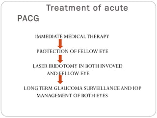 Treatment of acute
PACG
IMMEDIATE MEDICALTHERAPY
PROTECTION OF FELLOW EYE
LASER IRIDOTOMY IN BOTH INVOVED
AND FELLOW EYE
LONGTERM GLAUCOMA SURVEILLANCE AND IOP
MANAGEMENT OF BOTH EYES
 