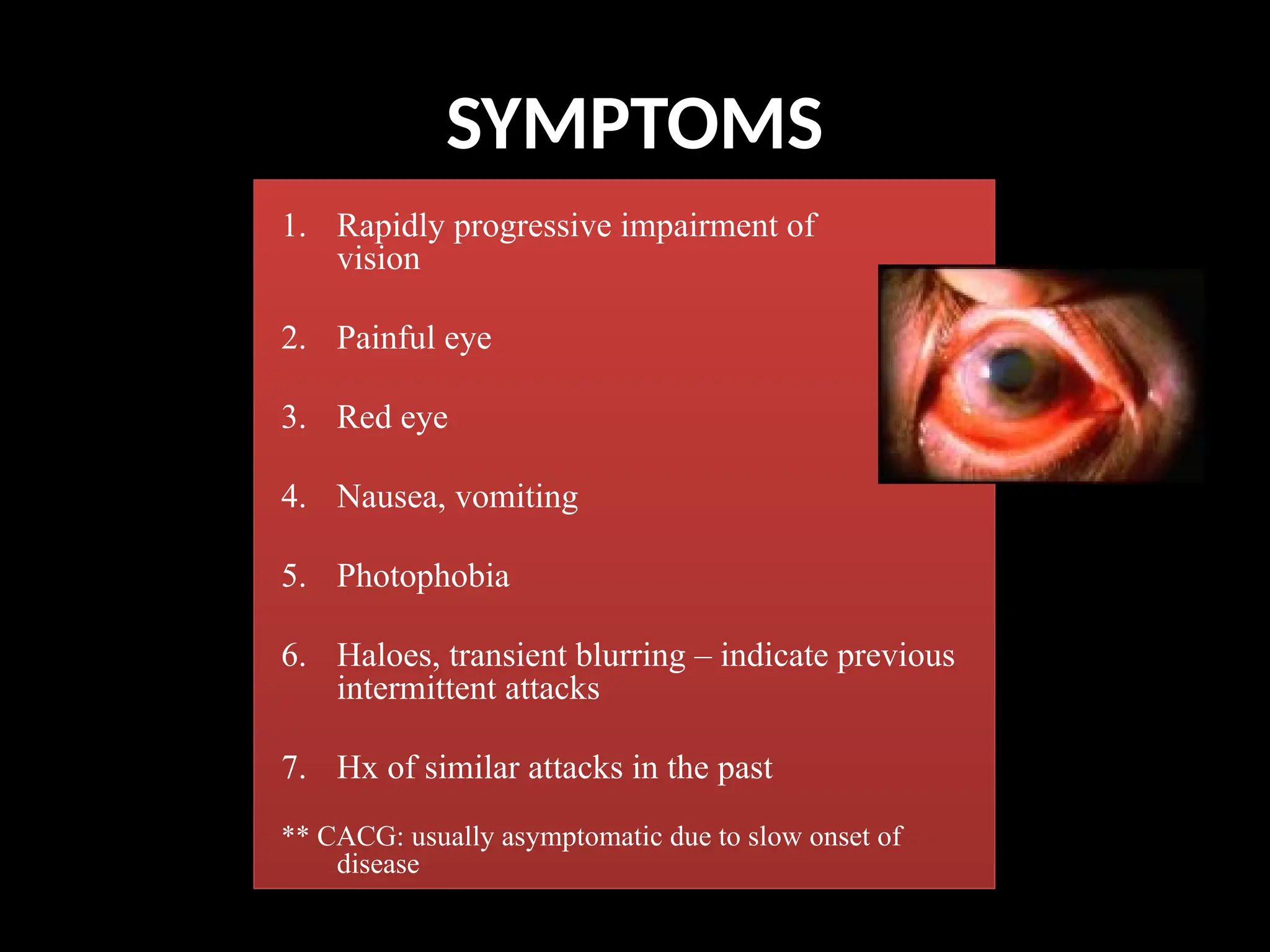 SYMPTOMS
1. Rapidly progressive impairment of
vision
2. Painful eye
3. Red eye
4. Nausea, vomiting
5. Photophobia
6. Haloes, transient blurring – indicate previous
intermittent attacks
7. Hx of similar attacks in the past
** CACG: usually asymptomatic due to slow onset of
disease
 