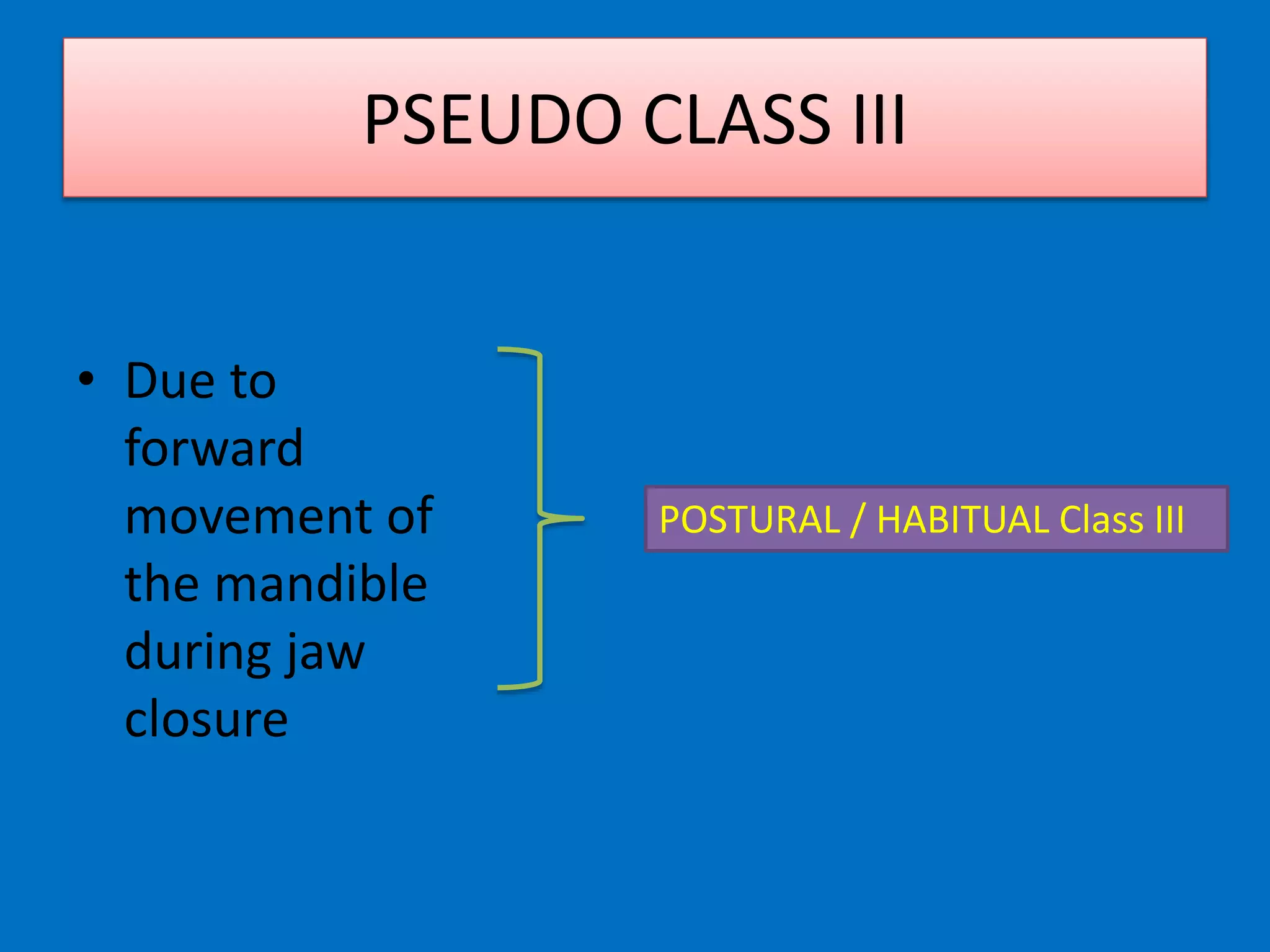 • Due to
forward
movement of
the mandible
during jaw
closure
POSTURAL / HABITUAL Class III
PSEUDO CLASS III