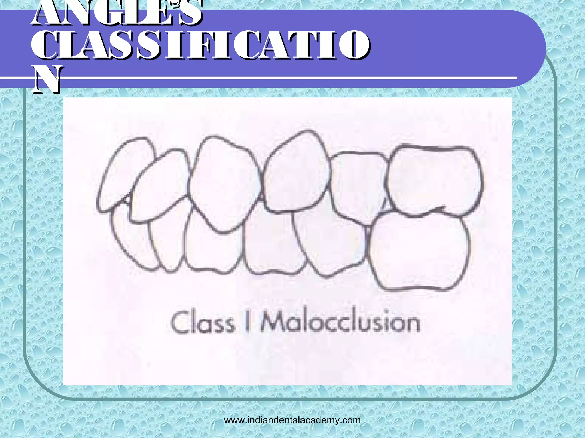 Angles classification /certified fixed orthodontic courses by Indian ...