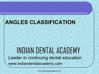 ANGLES CLASSIFICATION

INDIAN DENTAL ACADEMY
Leader in continuing dental education
www.indiandentalacademy.com
www.indiandentalacademy.com

 