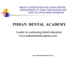 ANGLES CLASSIFICATION AND CEPHALOMETRIC
MEASUREMENTS OF FACIAL PROGNATHISM AND
SAGITTAL APICAL BASE DIFFERENCE

INDIAN DENTAL ACADEMY
Leader in continuing dental education
www.indiandentalacademy.com

www.indiandentalacademy.com

 