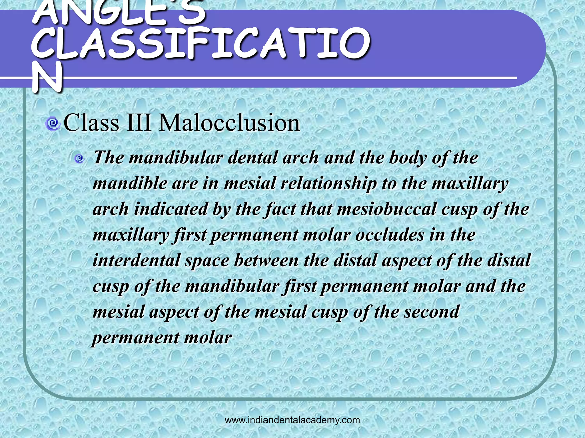 Angles classification & its shortcoming 2 /certified fixed orthodontic ...