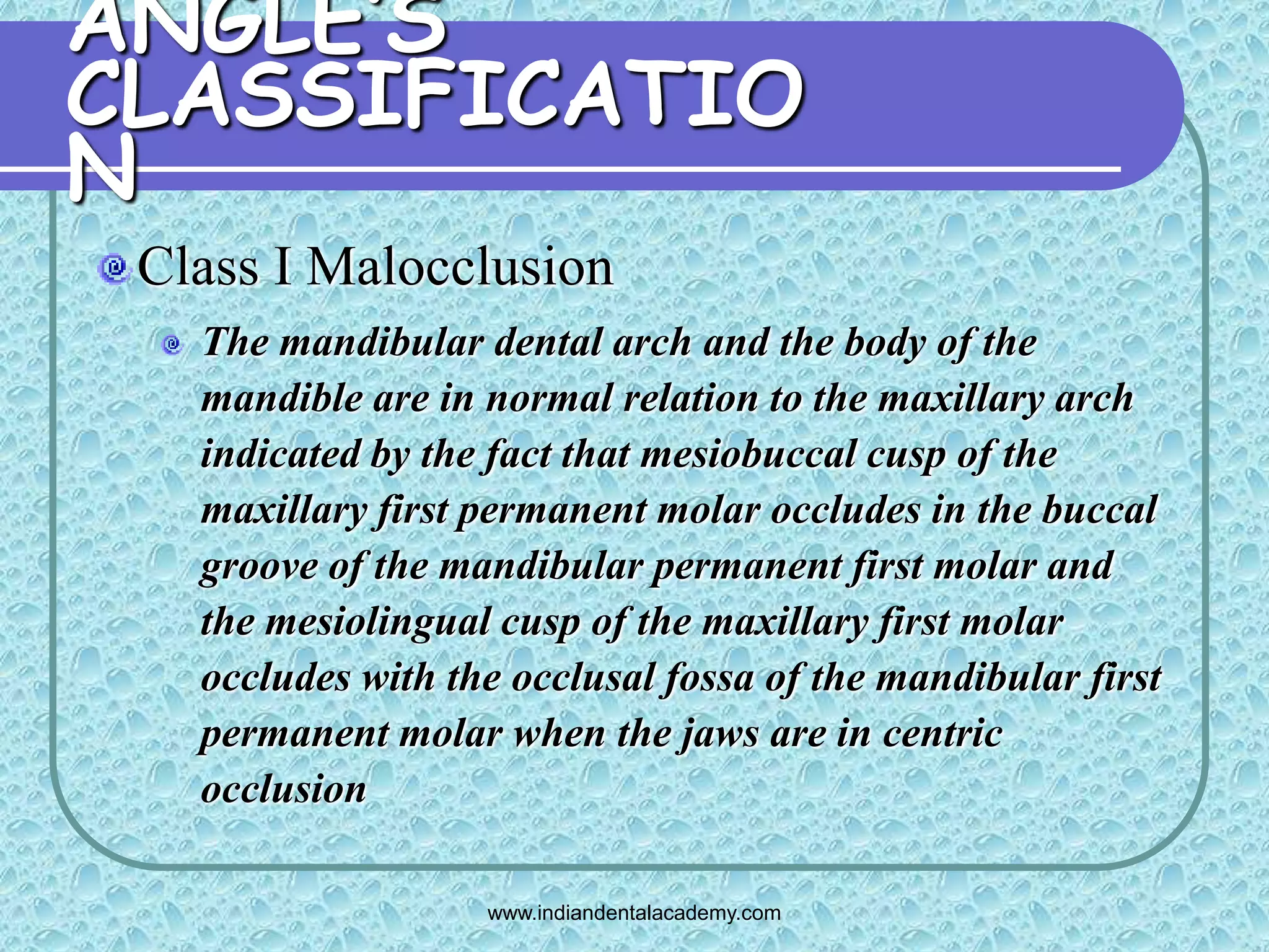 Angles classification & its shortcoming 2 /certified fixed orthodontic ...