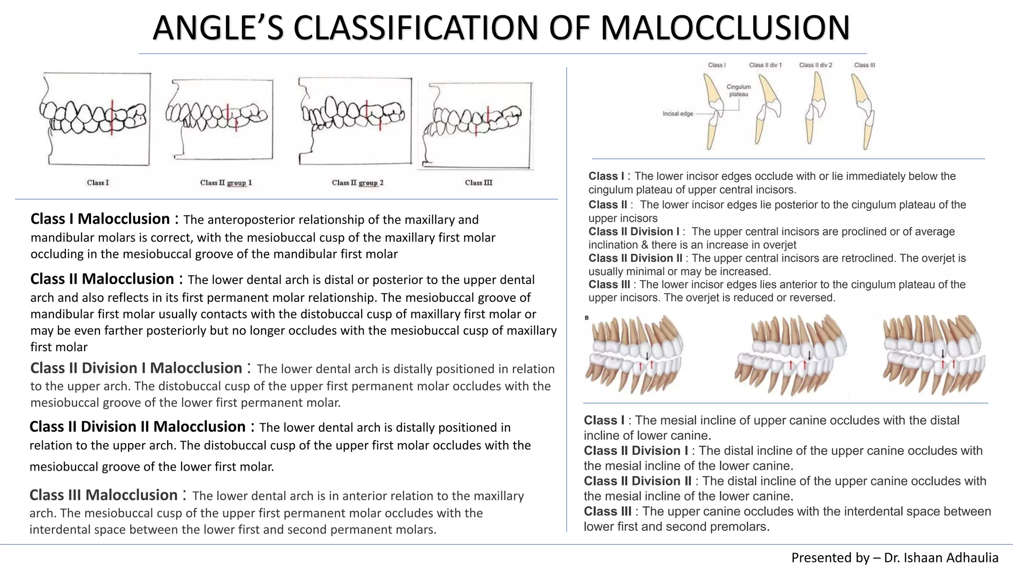 Angle s classification of malocclusion ppt