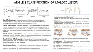 Angle's Classification Of Malocclusion | PDF | Dental Health | Diseases ...