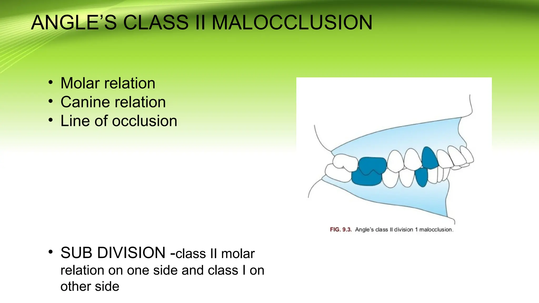 Angle’s classification of malocclusion. (2).pptx