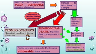 Daño en la Cápsula de
PLACA VULNERABLE
(mecánico, inflamatorio)
Contacto de
factor tisular con
la sangre
REPARACION
(cicatrización) o
PLACA ESTABLE
Capa de
plaquetas,
mínimo
trombo
TROMBO OCLUSIVO
Plaquetas+ trombina + fibrina
y hematíes
TROMBO MURAL
O LABIL. Isquemia.
Gran crecimiento de la
placa,
Progresión
de la lesión
Posible isquemia continuada. Puede seguir
vulnerable, Puede embolizar
Gran daño en la
cápsula o factores
trombogenicos
 