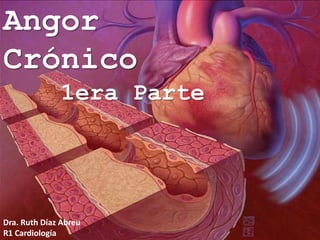 Angor
Crónico
1era Parte
Dra. Ruth Díaz Abreu
R1 Cardiología
 