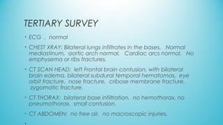 TERTIARY SURVEY
• ECG  .  normal
• CHEST XRAY: Bilateral lungs infiltrates in the bases.   Normal
mediastinum,  aortic arch normal.   Cardiac arcs normal.   No
emphysema or ribs fractures.  
• CT SCAN HEAD:  left Frontal brain contusion, with bilateral
brain edema, bilateral subdural temporal hematomas,  eye
orbit fracture,  nose fracture,  cribose membrane fracture,
 zygomatic fracture.
• CT THORAX:  bilateral base infiltration,  no hemothorax, no
pneumothorax,  small contusion.  
• CT ABDOMEN:  no free air,  no macroscopic injuries.
 