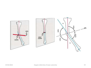 ANGULAR DEFORMITY OF THE LOWER EXTREMITY.pptx