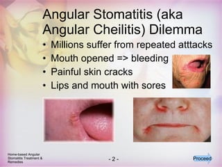 Angular Stomatitis (aka Angular Cheilitis) Dilemma Millions suffer from repeated atttacks Mouth opened => bleeding Painful skin cracks Lips and mouth with sores Home-based Angular Stomatitis Treatment & Remedies Proceed 