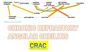 Salivary stasis
& digestion
epith integrity
fungi/bact.
colonization
epithelial
damage
pain, bleeding,
discomfort, pruritus
poor hygiene
poor intakerapid weight loss
accentuated
marionette
lip licking
Malnutrition
 