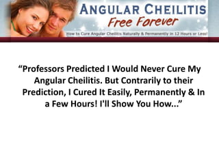   “Professors Predicted I Would Never Cure My Angular Cheilitis. But Contrarily to their Prediction, I Cured It Easily, Permanently & In a Few Hours! I'll Show You How...” 