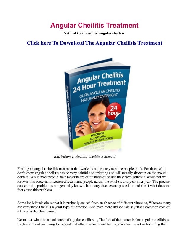 Overnight Angular cheilitis treatment