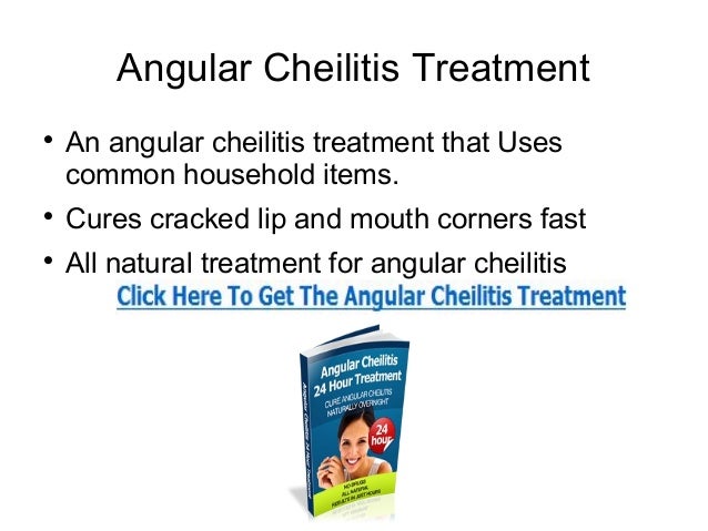 Angular Cheilitis Treatment That Works