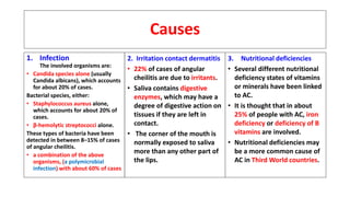 Causes
1. Infection
The involved organisms are:
• Candida species alone (usually
Candida albicans), which accounts
for about 20% of cases.
Bacterial species, either:
• Staphylococcus aureus alone,
which accounts for about 20% of
cases.
• β-hemolytic streptococci alone.
These types of bacteria have been
detected in between 8–15% of cases
of angular cheilitis.
• a combination of the above
organisms, (a polymicrobial
infection) with about 60% of cases
2. Irritation contact dermatitis
• 22% of cases of angular
cheilitis are due to irritants.
• Saliva contains digestive
enzymes, which may have a
degree of digestive action on
tissues if they are left in
contact.
• The corner of the mouth is
normally exposed to saliva
more than any other part of
the lips.
3. Nutritional deficiencies
• Several different nutritional
deficiency states of vitamins
or minerals have been linked
to AC.
• It is thought that in about
25% of people with AC, iron
deficiency or deficiency of B
vitamins are involved.
• Nutritional deficiencies may
be a more common cause of
AC in Third World countries.
 