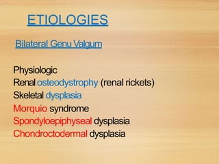 ETIOLOGIES
Bilateral GenuValgum
Physiologic
Renalosteodystrophy (renal rickets)
Skeletal dysplasia
Morquio syndrome
Spondyloepiphyseal dysplasia
Chondroctodermal dysplasia
 