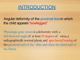 INTRODUCTION
Angular deformity of the proximal tibiain which
the child appears“bowlegged”
Physiologic genuvarum isadeformity with a
tibiofemoral angle of at least 10degreesof varus,a
radiographically normal physis, and apexlateral bowing of
the proximal end of the tibia and often the distal end of
the femur.
 