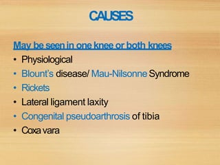 CAUSES
May beseenin onekneeor both knees
• Physiological
• Blount’s disease/ Mau-NilsonneSyndrome
• Rickets
• Lateral ligament laxity
• Congenital pseudoarthrosis of tibia
• Coxavara
 