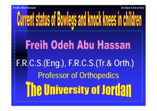 Freih Abu Hassan Jordan University 
F.R.C.S.(Eng.), F.R.C.S.(Tr.& Orth.) 
Professor of Orthopedics 
 
