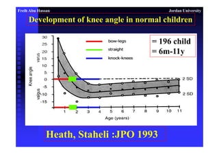 تقوس الارجل عن الاطفال Angular deformity in children lower limbs ...