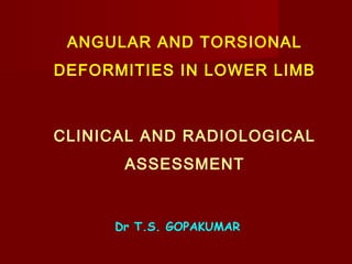 ANGULAR AND TORSIONAL
DEFORMITIES IN LOWER LIMB
CLINICAL AND RADIOLOGICAL
ASSESSMENT
Dr T.S. GOPAKUMAR
 