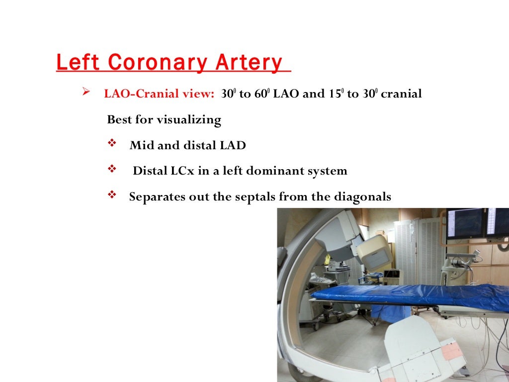 Angulated views in coronary angiography,an introductory lecture for c…