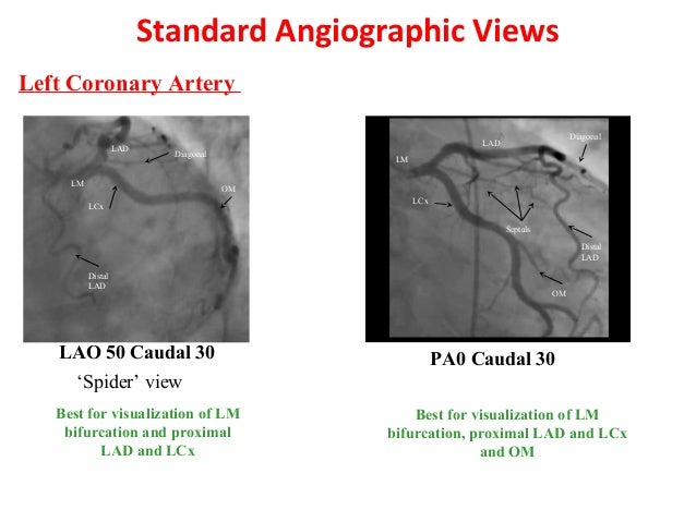 Angulated views in coronary angiography,an introductory lecture for c…