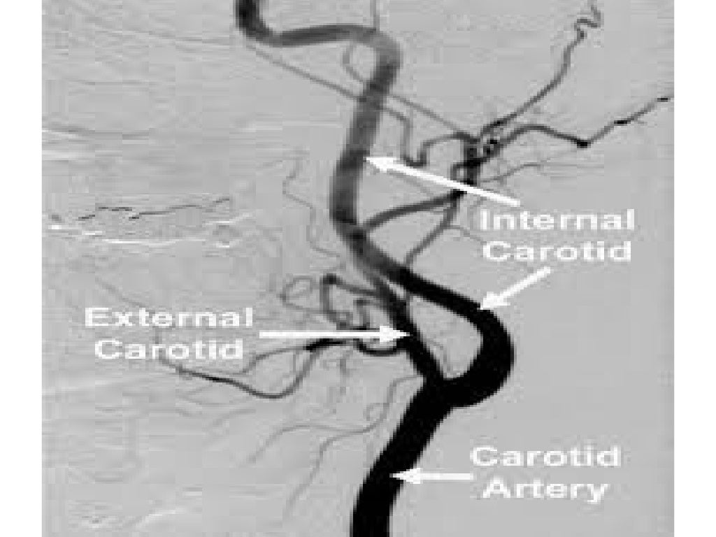 Angulated views in coronary angiography,an introductory lecture for c…