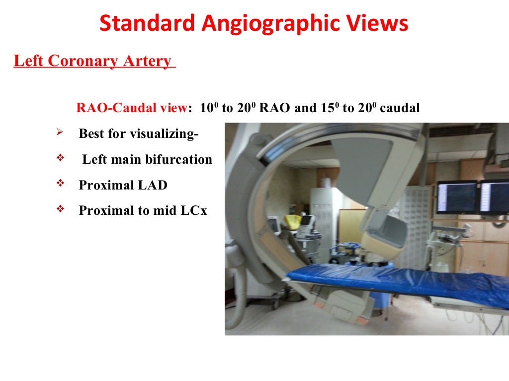 Angulated views in coronary angiography,an introductory lecture for c…