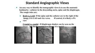 Cath Angles Rao angulated views Cardiac.pptx angulated views Cardiac.pptx
