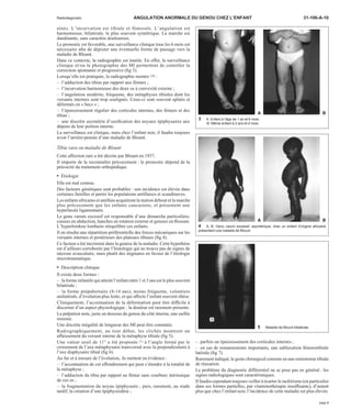 Radiodiagnostic ANGULATION ANORMALE DU GENOU CHEZ L’ENFANT 31-106-A-10 
aînés. L’incurvation est tibiale et fémorale. L’angulation est 
harmonieuse, bilatérale, le plus souvent symétrique. La marche est 
dandinante, sans caractère douloureux. 
Le pronostic est favorable, une surveillance clinique tous les 6 mois est 
nécessaire afin de dépister une éventuelle forme de passage vers la 
maladie de Blount. 
Dans ce contexte, la radiographie est inutile. En effet, la surveillance 
clinique et/ou la photographie des MI permettent de contrôler la 
correction spontanée et progressive (fig 3). 
Lorsqu’elle est pratiquée, la radiographie montre [10] : 
– l’adduction des tibias par rapport aux fémurs ; 
– l’incurvation harmonieuse des deux os à convexité externe ; 
– l’angulation modérée, fréquente, des métaphyses tibiales dont les 
versants internes sont trop soulignés. Ceux-ci sont souvent aplatis et 
déformés en « becs » ; 
– l’épaississement régulier des corticales internes, des fémurs et des 
tibias ; 
– une discrète asymétrie d’ossification des noyaux épiphysaires aux 
dépens de leur portion interne. 
La surveillance est clinique, mais chez l’enfant noir, il faudra toujours 
avoir l’arrière-pensée d’une maladie de Blount. 
Tibia vara ou maladie de Blount 
Cette affection rare a été décrite par Blount en 1937. 
Il importe de la reconnaître précocement : le pronostic dépend de la 
précocité du traitement orthopédique. 
· Étiologie 
Elle est mal connue. 
Des facteurs génétiques sont probables : son incidence est élevée dans 
certaines familles et parmi les populations antillaises et scandinaves. 
Les enfants africains et antillais acquièrent la station debout et la marche 
plus précocement que les enfants caucasiens, et présentent une 
hyperlaxité ligamentaire. 
Le genu varum excessif est responsable d’une démarche particulière, 
cuisses en abduction, hanches en rotation externe et genoux en flessum. 
L’hyperlordose lombaire rééquilibre ces enfants. 
Il en résulte une répartition préférentielle des forces mécaniques sur les 
versants internes et postérieurs des plateaux tibiaux (fig 4). 
Ce facteur a été incriminé dans la genèse de la maladie. Cette hypothèse 
est d’ailleurs corroborée par l’histologie qui ne trouve pas de signes de 
nécrose avasculaire, mais plutôt des stigmates en faveur de l’étiologie 
microtraumatique. 
· Description clinique 
Il existe deux formes : 
– la forme infantile qui atteint l’enfant entre 1 et 3 ans est le plus souvent 
bilatérale ; 
– la forme prépubertaire (8-14 ans), moins fréquente, volontiers 
unilatérale, d’évolution plus lente, et qui affecte l’enfant souvent obèse. 
Cliniquement, l’accentuation de la déformation peut être difficile à 
discerner d’un aspect physiologique ; la douleur est rarement présente. 
La palpation note, juste en dessous du genou du côté interne, une saillie 
osseuse. 
Une discrète inégalité de longueur des MI peut être constatée. 
Radiographiquement, au tout début, les clichés montrent un 
affaissement du versant interne de la métaphyse tibiale (fig 5). 
Une valeur seuil de 11° a été proposée [7] à l’angle formé par le 
croisement de l’axe métaphysaire transversal avec la perpendiculaire à 
l’axe diaphysaire tibial (fig 6). 
Au fur et à mesure de l’évolution, ils mettent en évidence : 
– l’accentuation de cet effondrement qui peut s’étendre à la totalité de 
la métaphyse ; 
– l’adduction du tibia par rapport au fémur sans courbure intrinsèque 
de ces os ; 
– la fragmentation du noyau épiphysaire ; puis, rarement, au stade 
tardif, la création d’une épiphysiodèse ; 
A B 
3 A. Enfant à l’âge de 1 an et 6 mois. 
B. Même enfant à 2 ans et 4 mois. 
A B 
4 A, B. Genu varum excessif, asymétrique, chez un enfant d’origine africaine 
présentant une maladie de Blount. 
5 Maladie de Blount bilatérale. 
– parfois un épaississement des corticales internes ; 
– en cas de remaniements importants, une subluxation fémorotibiale 
latérale (fig 7). 
Rarement indiqué, le geste chirurgical consiste en une ostéotomie tibiale 
de réaxation. 
Le problème du diagnostic différentiel ne se pose pas en général : les 
signes radiologiques sont caractéristiques. 
Il faudra cependant toujours veiller à écarter le rachitisme (en particulier 
dans ses formes partielles, par vitaminothérapie insuffisante), d’autant 
plus que chez l’enfant noir, l’incidence de cette maladie est plus élevée. 
page 3 
 