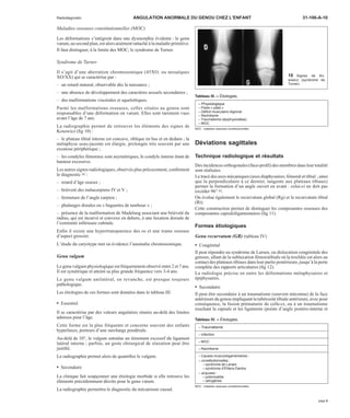 Radiodiagnostic ANGULATION ANORMALE DU GENOU CHEZ L’ENFANT 31-106-A-10 
Maladies osseuses constitutionnelles (MOC) 
Les déformations s’intègrent dans une dysmorphie évidente : le genu 
varum, au second plan, est alors aisément rattaché à la maladie primitive. 
Il faut distinguer, à la limite des MOC, le syndrome de Turner. 
Syndrome de Turner 
Il s’agit d’une aberration chromosomique (45XO, ou mosaïques 
XO/XX) qui se caractérise par : 
– un retard statural, observable dès la naissance ; 
– une absence de développement des caractères sexuels secondaires ; 
– des malformations viscérales et squelettiques. 
Parmi les malformations osseuses, celles situées au genou sont 
responsables d’une déformation en varum. Elles sont rarement vues 
avant l’âge de 7 ans. 
La radiographie permet de retrouver les éléments des signes de 
Kosowicz (fig 10) : 
– le plateau tibial interne est concave, oblique en bas et en dedans ; la 
métaphyse sous-jacente est élargie, prolongée très souvent par une 
exostose périphérique ; 
– les condyles fémoraux sont asymétriques, le condyle interne étant de 
hauteur excessive. 
Les autres signes radiologiques, observés plus précocement, confirment 
le diagnostic [8] : 
– retard d’âge osseux ; 
– brièveté des métacarpiens IV et V ; 
– fermeture de l’angle carpien ; 
– phalanges distales en « baguettes de tambour » ; 
– présence de la malformation de Madelung associant une brièveté du 
radius, qui est incurvé et convexe en dehors, à une luxation dorsale de 
l’extrémité inférieure cubitale. 
Enfin il existe une hypertransparence des os et une trame osseuse 
d’aspect grossier. 
L’étude du caryotype met en évidence l’anomalie chromosomique. 
Genu valgum 
Le genu valgum physiologique est fréquemment observé entre 2 et 7 ans. 
Il est symétrique et atteint sa plus grande fréquence vers 3-4 ans. 
Le genu valgum unilatéral, en revanche, est presque toujours 
pathologique. 
Les étiologies de ces formes sont données dans le tableau III. 
· Essentiel 
Il se caractérise par des valeurs angulaires situées au-delà des limites 
admises pour l’âge. 
Cette forme est la plus fréquente et concerne souvent des enfants 
hyperlaxes, porteurs d’une surcharge pondérale. 
Au-delà de 10°, le valgum entraîne un étirement excessif du ligament 
latéral interne ; parfois, un geste chirurgical de réaxation peut être 
justifié. 
La radiographie permet alors de quantifier le valgum. 
· Secondaire 
La clinique fait soupçonner une étiologie morbide si elle retrouve les 
éléments précédemment décrits pour le genu varum. 
La radiographie permettra le diagnostic du mécanisme causal. 
Tableau III. – Étiologies. 
– Physiologique 
– Pieds « plats » 
– Déficit musculaire régional 
– Rachitisme 
– Traumatisme (épiphysiodèse) 
– MOC 
MOC : maladies osseuses constitutionnelles. 
Déviations sagittales 
10 Signes de Ko-sowicz 
(syndrome de 
Turner). 
Technique radiologique et résultats 
Des incidences orthogonales (face-profil) des membres dans leur totalité 
sont réalisées. 
Le tracé des axes mécaniques (axes diaphysaires, fémoral et tibial ; ainsi 
que la perpendiculaire à ce dernier, tangente aux plateaux tibiaux) 
permet la formation d’un angle ouvert en avant : celui-ci ne doit pas 
excéder 96° [6]. 
On évalue également le recurvatum global (Rg) et le recurvatum tibial 
(Rt). 
Cette construction permet de distinguer les composantes osseuses des 
composantes capsuloligamentaires (fig 11). 
Formes étiologiques 
Genu recurvatum (GR) (tableau IV) 
· Congénital 
Il peut répondre au syndrome de Larsen, ou dislocation congénitale des 
genoux, allant de la subluxation fémorotibiale où la trochlée est alors au 
contact des plateaux tibiaux dans leur partie postérieure, jusqu’à la perte 
complète des rapports articulaires (fig 12). 
La radiologie précise en outre les déformations métaphysaires et 
épiphysaires. 
· Secondaire 
Il peut être secondaire à un traumatisme (souvent méconnu) de la face 
antérieure du genou impliquant la tubérosité tibiale antérieure, avec pour 
conséquence, la fusion prématurée de celle-ci, ou à un traumatisme 
touchant la capsule et les ligaments (points d’angle postéro-interne et 
Tableau IV. – Étiologies. 
– Traumatisme 
– Infection 
– MOC 
– Rachitisme 
– Causes musculoligamentaires : 
– constitutionnelles : 
– syndrome de Larsen 
– syndrome d’Ehlers-Danlos 
– acquises : 
– poliomyélite 
– iatrogènes 
MOC : maladies osseuses constitutionnelles. 
page 5 
 