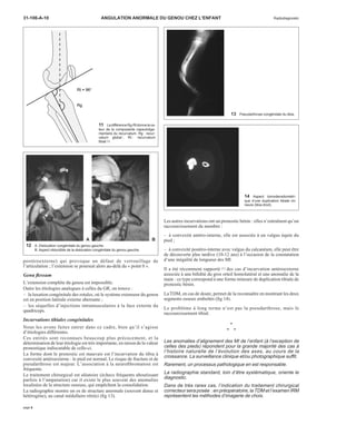 31-106-A-10 ANGULATION ANORMALE DU GENOU CHEZ L’ENFANT Radiodiagnostic 
A B 
postéroexterne) qui provoque un défaut de verrouillage de 
l’articulation ; l’extension se poursuit alors au-delà du « point 0 ». 
Genu flessum 
L’extension complète du genou est impossible. 
Outre les étiologies analogues à celles du GR, on trouve : 
– la luxation congénitale des rotules, où le système extenseur du genou 
est en position latérale externe aberrante ; 
– les séquelles d’injections intramusculaires à la face externe du 
quadriceps. 
Incurvations tibiales congénitales 
Nous les avons faites entrer dans ce cadre, bien qu’il s’agisse 
d’étiologies différentes. 
Ces entités sont reconnues beaucoup plus précocement, et la 
détermination de leur étiologie est très importante, en raison de la valeur 
pronostique indiscutable de celle-ci. 
La forme dont le pronostic est mauvais est l’incurvation du tibia à 
convexité antéroexterne : le pied est normal. Le risque de fracture et de 
pseudarthrose est majeur. L’association à la neurofibromatose est 
fréquente. 
Le traitement chirurgical est aléatoire (échecs fréquents aboutissant 
parfois à l’amputation) car il existe le plus souvent des anomalies 
localisées de la structure osseuse, qui empêchent la consolidation. 
La radiographie montre un os de structure anormale (souvent dense et 
hétérogène), au canal médullaire rétréci (fig 13). 
Les autres incurvations ont un pronostic bénin : elles n’entraînent qu’un 
raccourcissement du membre : 
– à convexité antéro-interne, elle est associée à un valgus équin du 
pied ; 
– à convexité postéro-interne avec valgus du calcanéum, elle peut être 
de découverte plus tardive (10-12 ans) à l’occasion de la constatation 
d’une inégalité de longueur des MI. 
Il a été récemment rapporté [1] des cas d’incurvation antéroexterne 
associée à une bifidité du gros orteil homolatéral et une anomalie de la 
main : ce type correspond à une forme mineure de duplication tibiale de 
pronostic bénin. 
La TDM, en cas de doute, permet de la reconnaître en montrant les deux 
segments osseux emboîtés (fig 14). 
Le problème à long terme n’est pas la pseudarthrose, mais le 
raccourcissement tibial. 
• 
• • 
Les anomalies d’alignement des MI de l’enfant (à l’exception de 
celles des pieds) répondent pour la grande majorité des cas à 
l’histoire naturelle de l’évolution des axes, au cours de la 
croissance. La surveillance clinique et/ou photographique suffit. 
Rarement, un processus pathologique en est responsable. 
La radiographie standard, loin d’être systématique, oriente le 
diagnostic. 
Dans de très rares cas, l’indication du traitement chirurgical 
correcteur sera posée : en préopératoire, laTDMet l’examen IRM 
représentent les méthodes d’imagerie de choix. 
Rt = 96° 
Rg 
11 La différence Rg-Rt donne la va-leur 
de la composante capsuloliga-mentaire 
du recurvatum. Rg : recur-vatum 
global ; Rt : recurvatum 
tibial [6]. 
12 A. Dislocation congénitale du genou gauche. 
B. Aspect réductible de la dislocation congénitale du genou gauche. 
13 Pseudarthrose congénitale du tibia. 
14 Aspect tomodensitométri-que 
d’une duplication tibiale mi-neure 
(tibia droit). 
page 6 
 