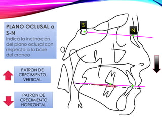 S
N
PATRON DE
CRECIMIENTO
VERTICAL
PATRON DE
CRECIMIENTO
HORIZONTAL
PLANO OCLUSAL a
S-N
Indica la inclinación
del plano oclusal con
respecto a la base
del craneo
 