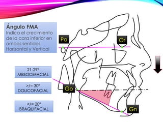 Po Or
21-29°
MESOCEFACIAL
</= 20°
BRAQUIFACIAL
Ángulo FMA
Indica el crecimiento
de la cara inferior en
ambos sentidos
Horizontal y Vertical
Gn
>/= 30°
DOLICOFACIAL Go
 
