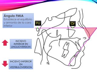 Po Or
INCISIVO
INFERIOR EN
LINGUOVERSION
INCISIVO INFERIOR
EN
VESTIBULOVERSION
Ángulo FMIA
Establece el equilibrio
y armonía de la cara
inferior
 