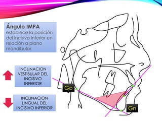 INCLINACION
VESTIBULAR DEL
INCISIVO
INFERIOR
INCLINACION
LINGUAL DEL
INCISIVO INFERIOR
Ángulo IMPA
establece la posición
del incisivo inferior en
relación a plano
mandibular
Gn
Go
 