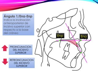 PROINCLINACION
DEL INCISIVO
SUPERIOR
RETROINCLINACION
DEL INCISIVO
SUPERIOR
Ángulo 1/Ena-Enp
Indica la inclinación
anteroposterior de
incisivo superior con
respecto a la base
del cráneo
EnaEnp
 